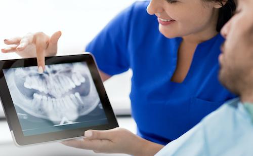 man at the dentist for full mouth rehab in coburg north