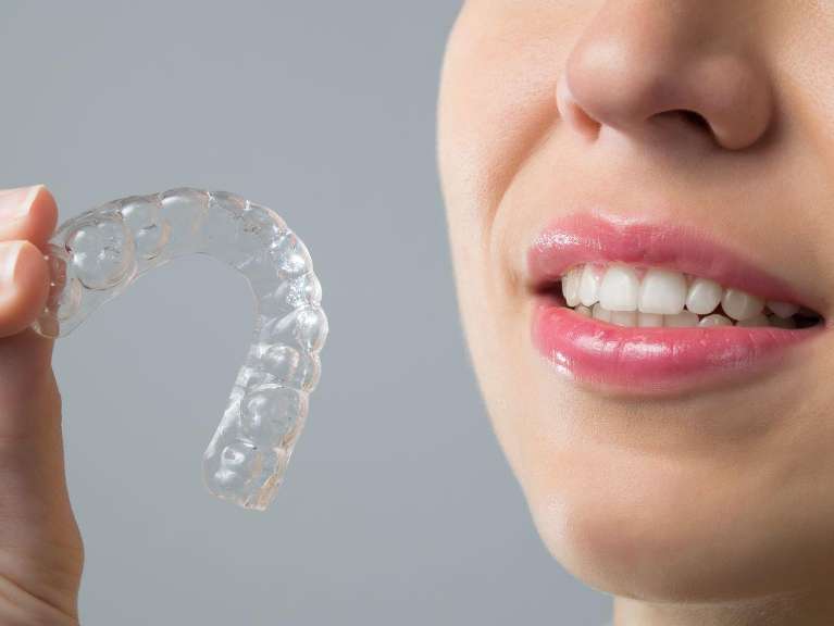 woman holding invisalign clear braces in coburgh north