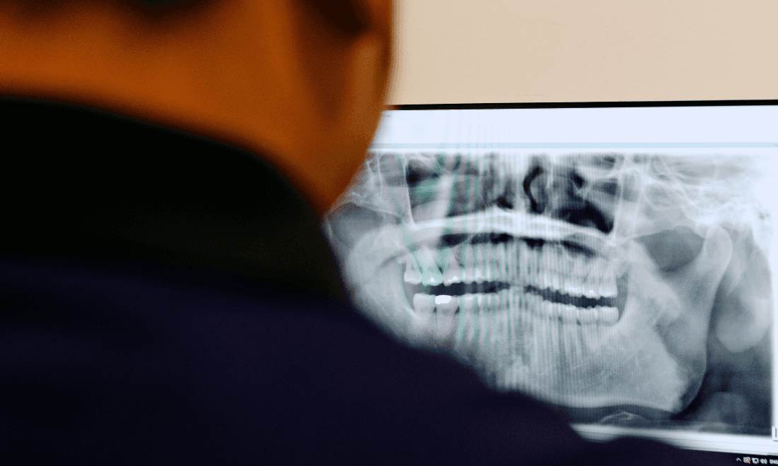 Coburg North Dentist Reviewing Digital X-ray Coburg North Dentist Reviewing Digital X-ray