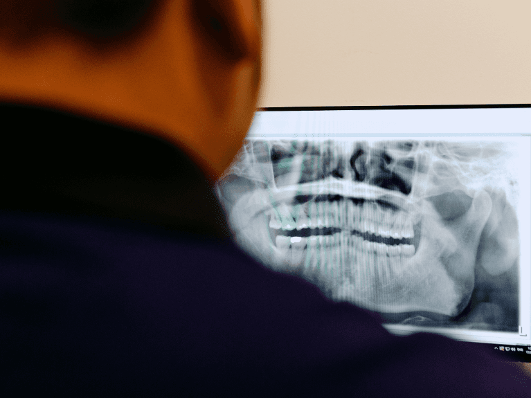 coburg north dentist reviewing panoramic x-rays
